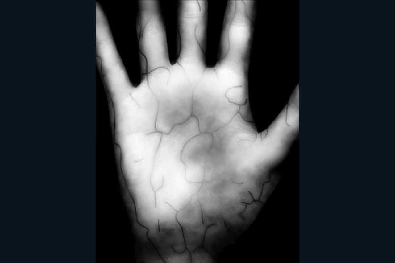 Handvenenmuster